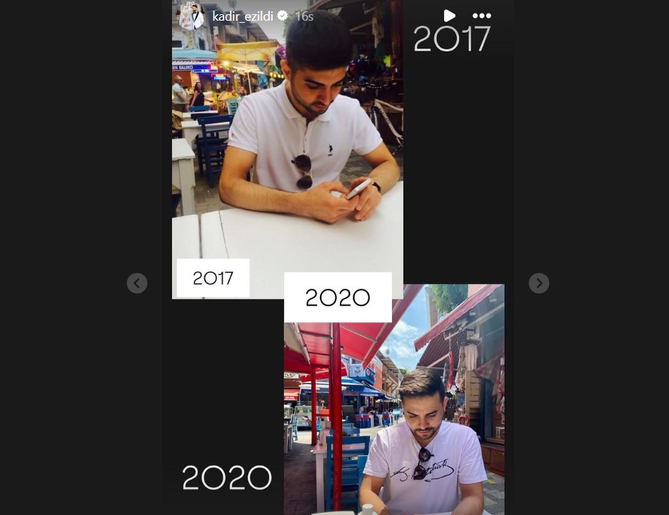 Kadir Ezildi eski burnu?