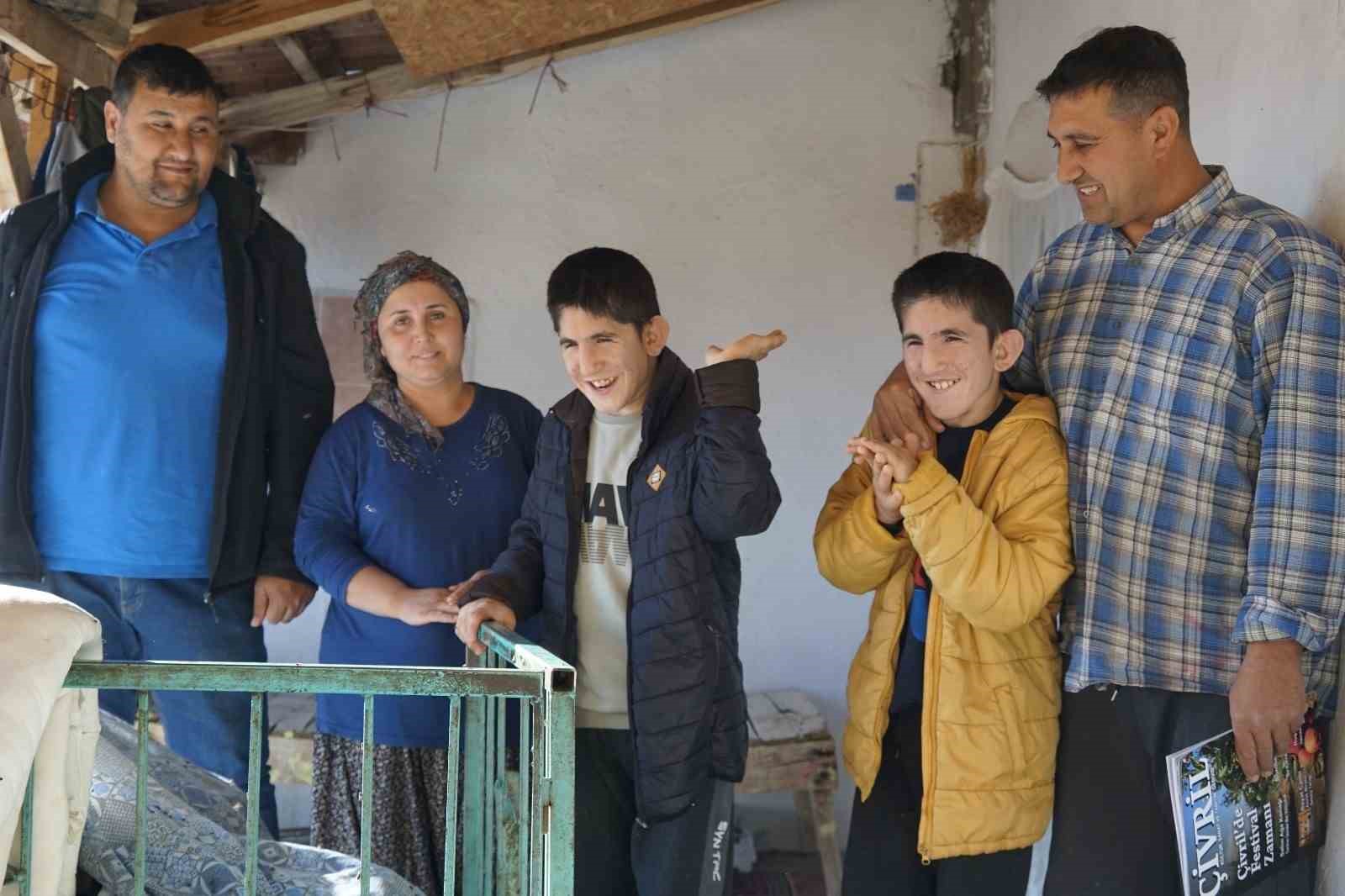 13 yasindaki ikizler kromozom 4q delesyon sendromu ile mucadele ediyor 2