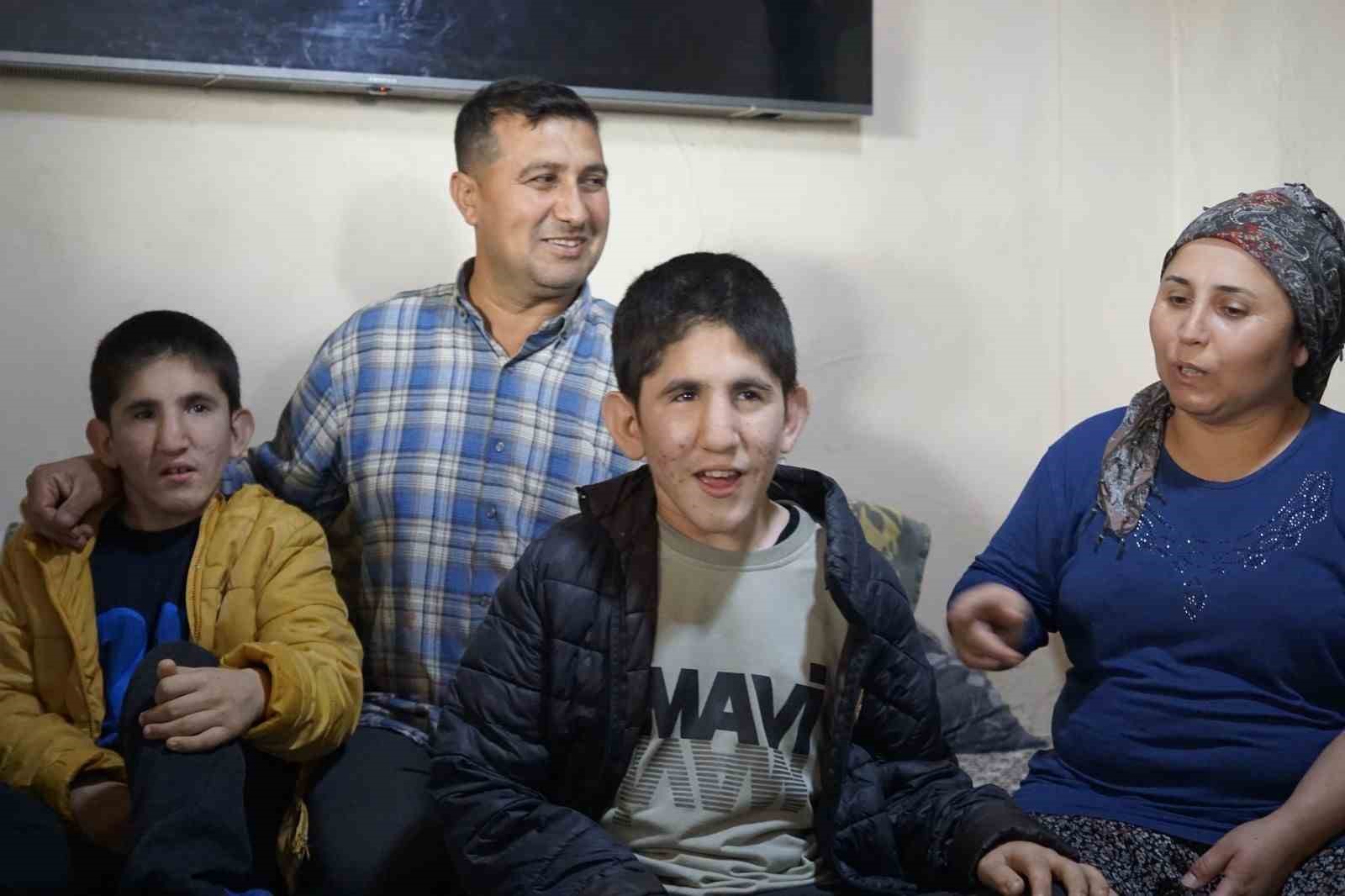 13 yasindaki ikizler kromozom 4q delesyon sendromu ile mucadele ediyor 3 v36BrsU5
