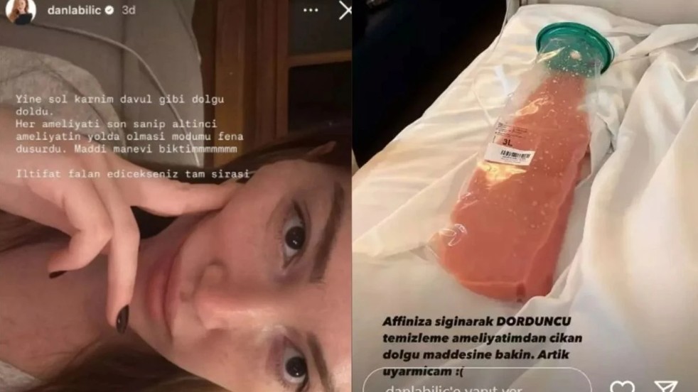Danla Biliç estetik sürecini neden bu kadar açık anlatıyor?
