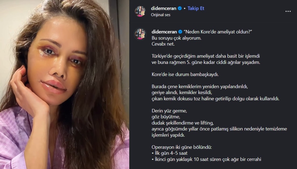 Didem Ceran hangi işlemleri yaptırdığını açıkladı mı?