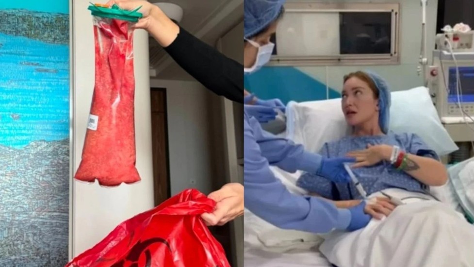 Danla Biliç estetik sürecini neden bu kadar açık anlatıyor?