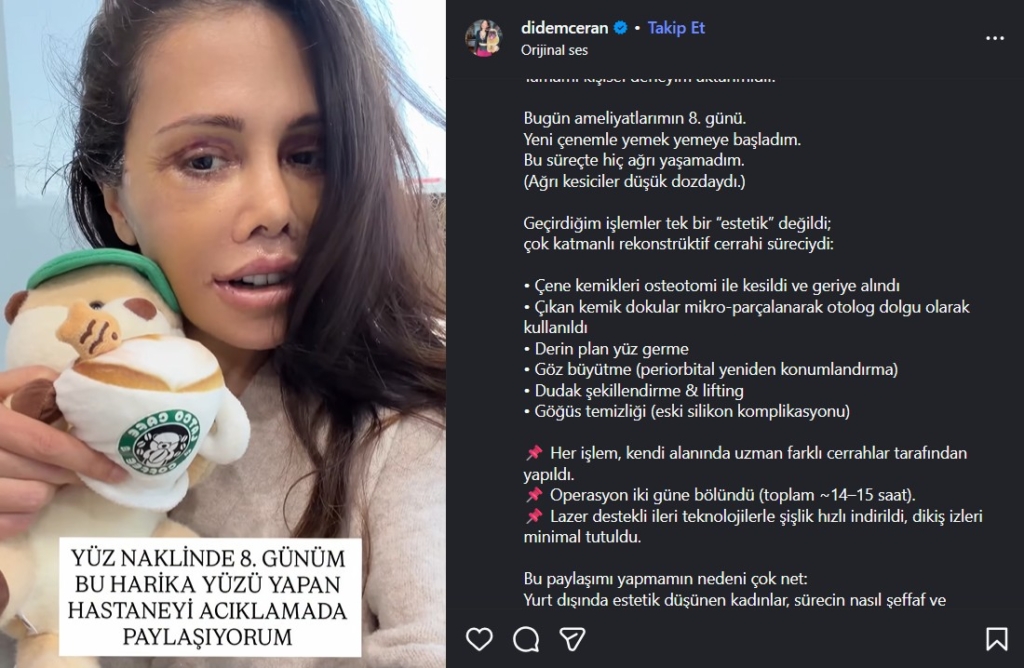 Didem Ceran ameliyat sürecini nasıl anlattı?