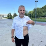 15-temmuz-gazisi-musa-ilhan-kalbinin-altindaki-hain-kursunla-10-yildir-yasiyor-3uYJG7DP.jpg