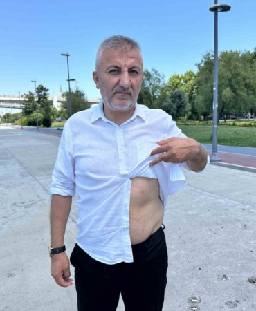 15-temmuz-gazisi-musa-ilhan-kalbinin-altindaki-hain-kursunla-10-yildir-yasiyor-3uYJG7DP.jpg