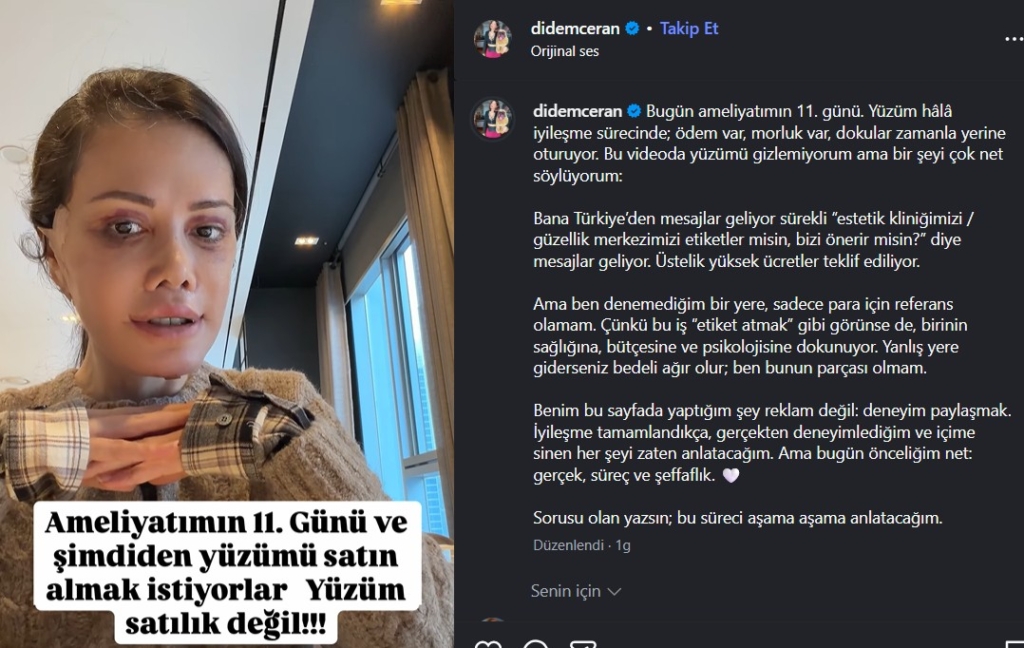 Didem Ceran ameliyat sürecini nasıl anlattı?