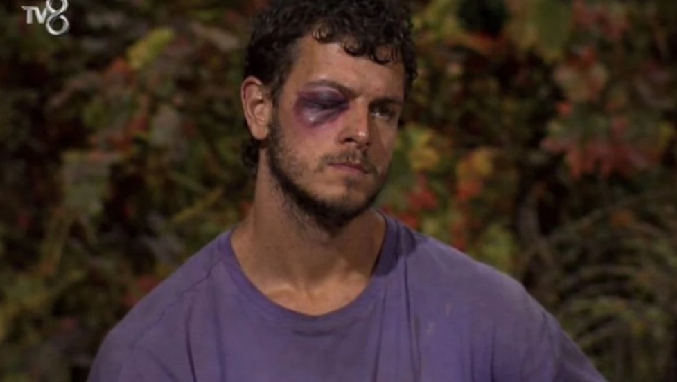 Survivor engincan mor göz fotoğrafı yapay zekâ ürünü mü?