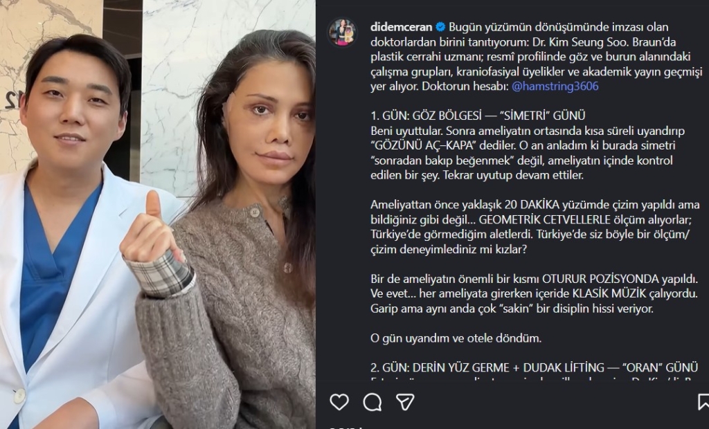 Didem Ceran’ın yeni hali neden bu kadar konuşuldu?