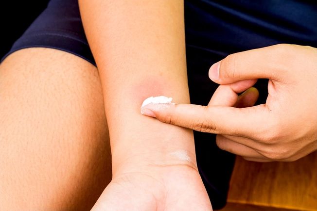 Peki sirke ve karbonat karışımı hangi alanlarda işe yarıyor? 