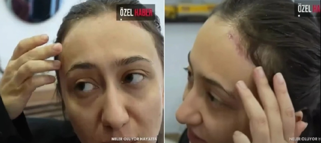 Güllü’nün Ölüm Gecesinin Tek Tanığı Sultan’ın Kamera Arkası Görüntüleri Şoke Etti