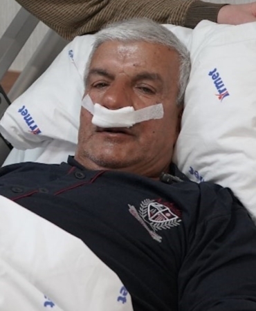 65-yasindaki-adamin-burnundan-100-gramlik-tas-cikarildi-uJYKp8lM.jpg