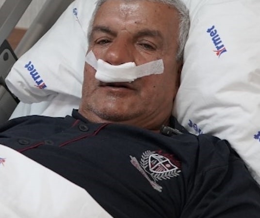 65-yasindaki-adamin-burnundan-100-gramlik-tas-cikarildi-uJYKp8lM.jpg
