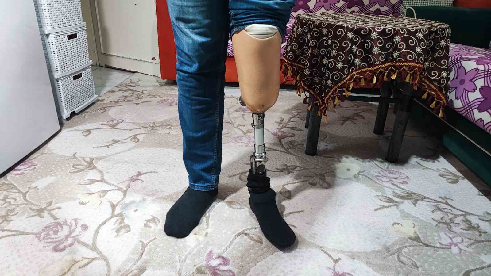 700 lira icin verdigi iban protez bacakli sahsin hayatini karartti 0 WigtPtrA