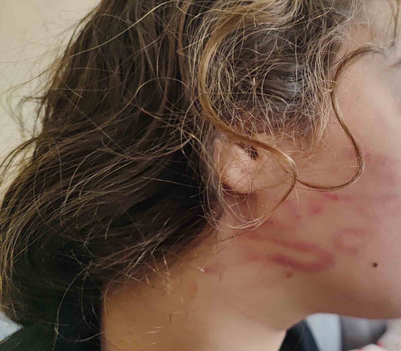 8 yaşındaki kızını darp eden çocuğun epilepsi hastası ablasını sokak ortasında dövdüğü iddiası 5 8 yasindaki kizini darp eden cocugun epilepsi hastasi ablasini sokak ortasinda dovdugu iddiasi 1 uwXEZjj7
