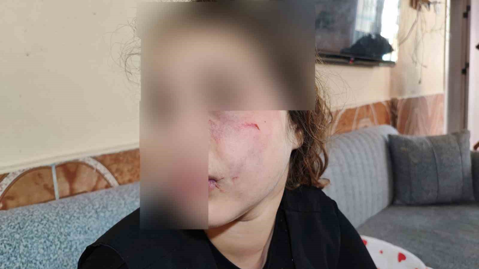 8 yaşındaki kızını darp eden çocuğun epilepsi hastası ablasını sokak ortasında dövdüğü iddiası 7 8 yasindaki kizini darp eden cocugun epilepsi hastasi ablasini sokak ortasinda dovdugu iddiasi 3 nmzBCVdc