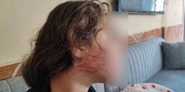 8-yasindaki-kizini-darp-eden-cocugun-epilepsi-hastasi-ablasini-sokak-ortasinda-dovdugu-iddiasi-n8Kl5rAY.jpg