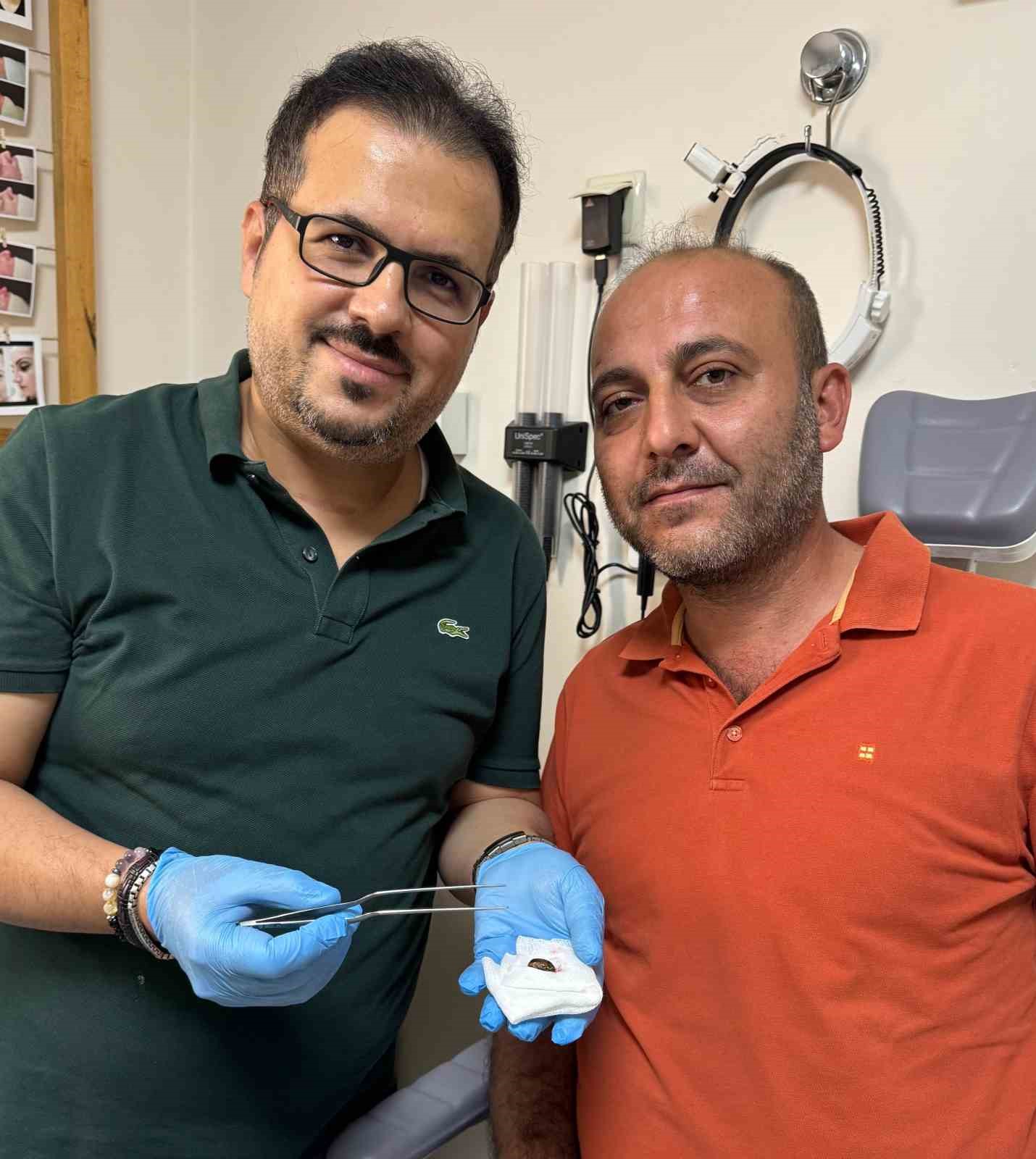Ağrı ve işitme kaybı nedeniyle hastaneye gitti, kulağından Japon böceği çıktı 6 agri ve isitme kaybi nedeniyle hastaneye gitti kulagindan japon bocegi cikti 2 27ZIpCbE