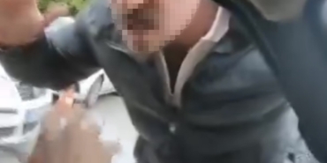 ailesinin-yaninda-saldiriya-ugradi-olayin-faturasi-430-bin-lira-oldu-pbvUF3l1.jpg