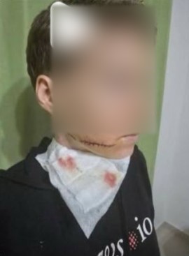 Alanya’da sokakta bir kadına yumruk atıp, makasla yüzünü yaralayan şahıs tutuklandı 7 alanyada sokakta bir kadina yumruk atip makasla yuzunu yaralayan sahis tutuklandi 3 mM5bGZb3