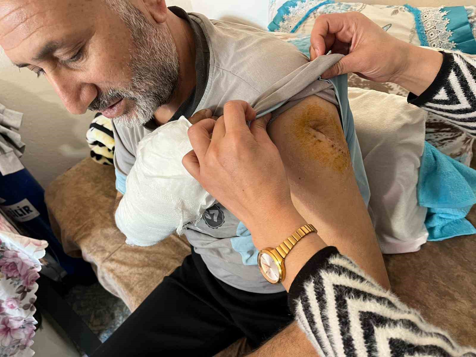 almanyadan cinayet icin gelmis ablasini oldurdu enistesini agir yaraladi 1 h5ANaTk7