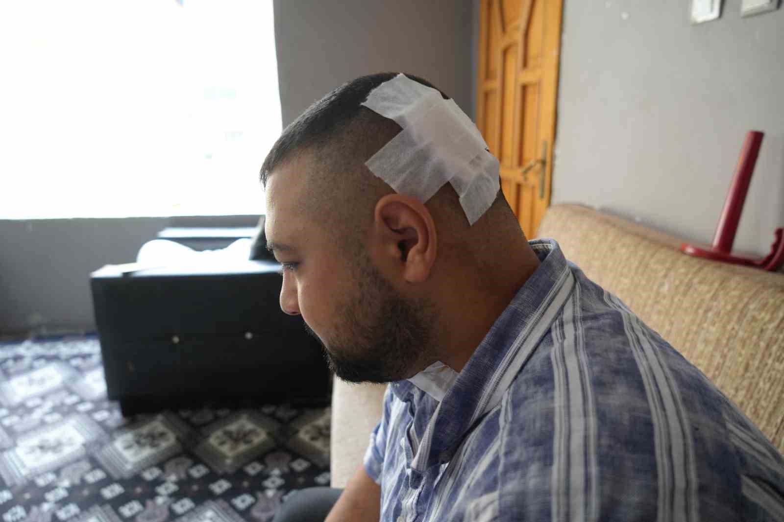 Amcası tarafından boğazından ve kafasında bıçaklanan motokurye: "Kendisi serbest, can güvenliğim yok" 5 amcasi tarafindan bogazindan ve kafasinda bicaklanan motokurye kendisi serbest can guvenligim yok 1 pf1UQQBQ