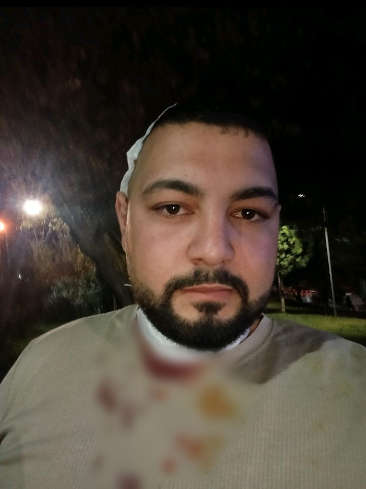 Amcası tarafından boğazından ve kafasında bıçaklanan motokurye: "Kendisi serbest, can güvenliğim yok" 8 amcasi tarafindan bogazindan ve kafasinda bicaklanan motokurye kendisi serbest can guvenligim yok 4 dsXQtnUD