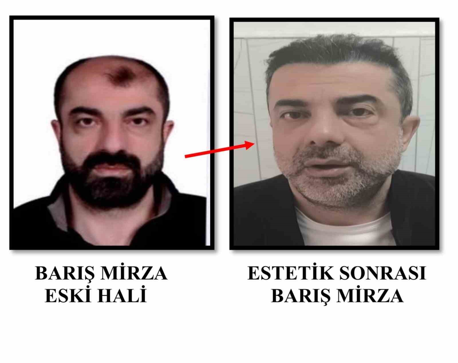 Ameliyat ile yüzünü değiştiren firari cinayet zanlısı, 7 yıl sonra yakalandı 4 ameliyat ile yuzunu degistiren firari cinayet zanlisi 7 yil sonra yakalandi 0