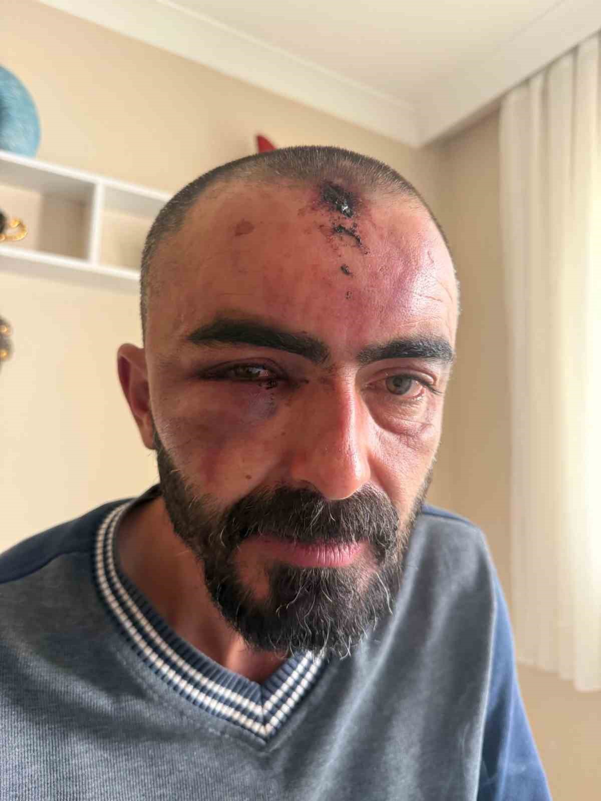 ankarada 4 aracin kundaklandigi olayin bir anlik sinirle yasandigi iddiasi 6 veOPDNqk