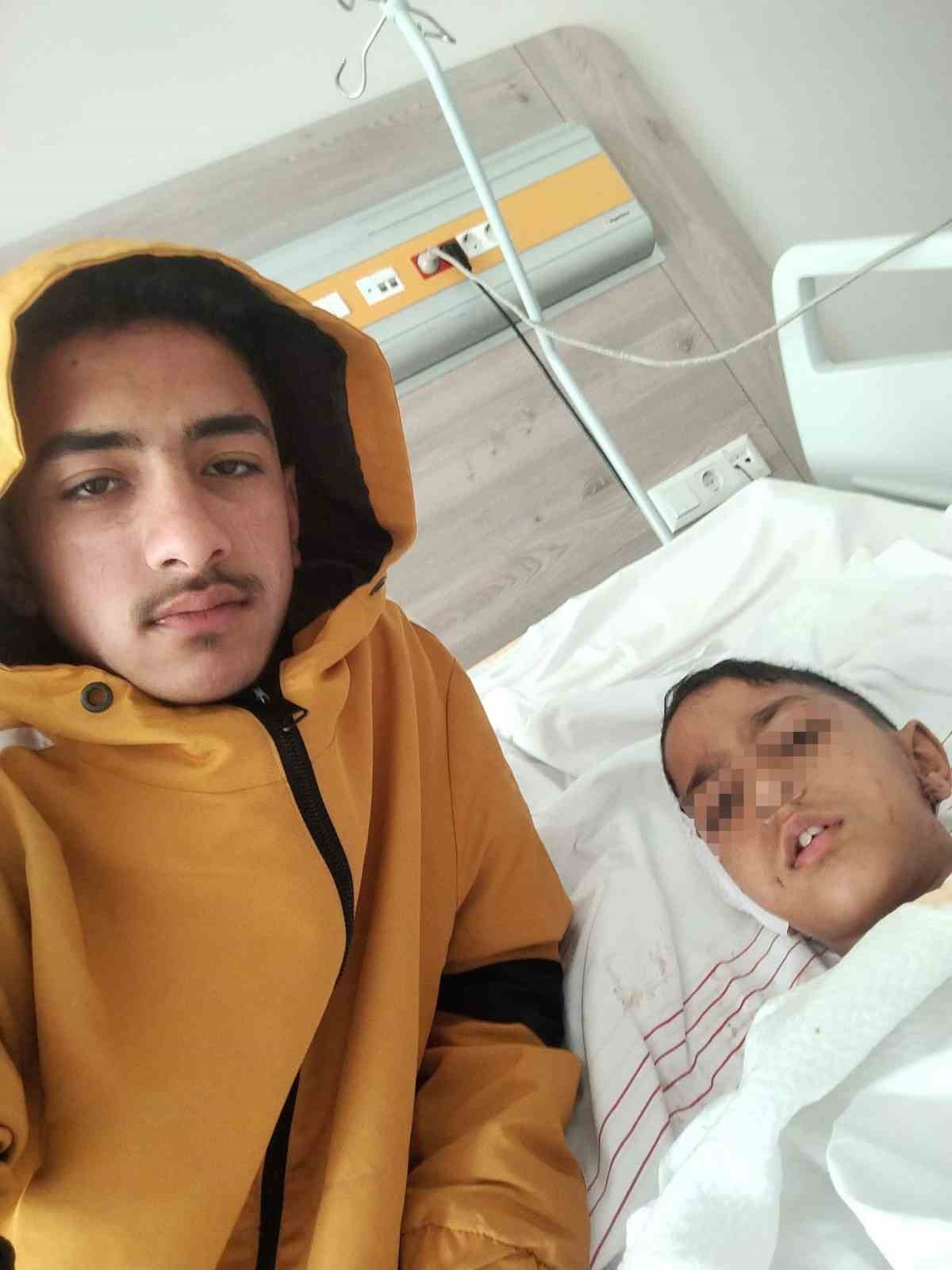 ankarada sokak kopeginin saldirisina ugrayan cocuk yaralandi 0 Bjc68Byw