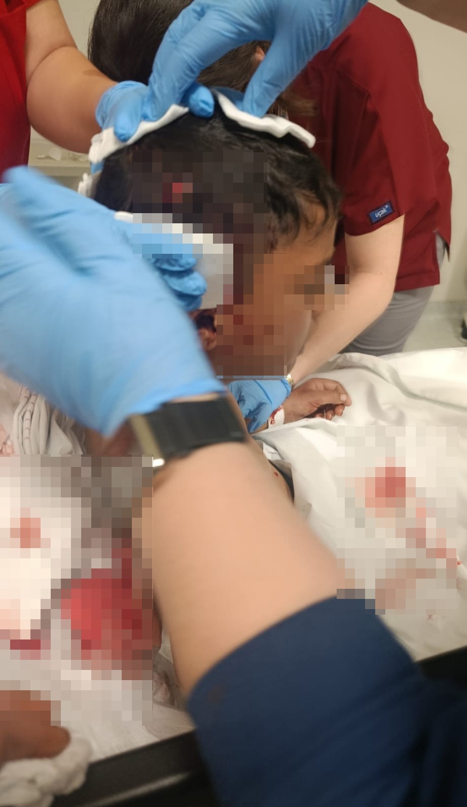 ankarada sokak kopeginin saldirisina ugrayan cocuk yaralandi 1 2baUtisU