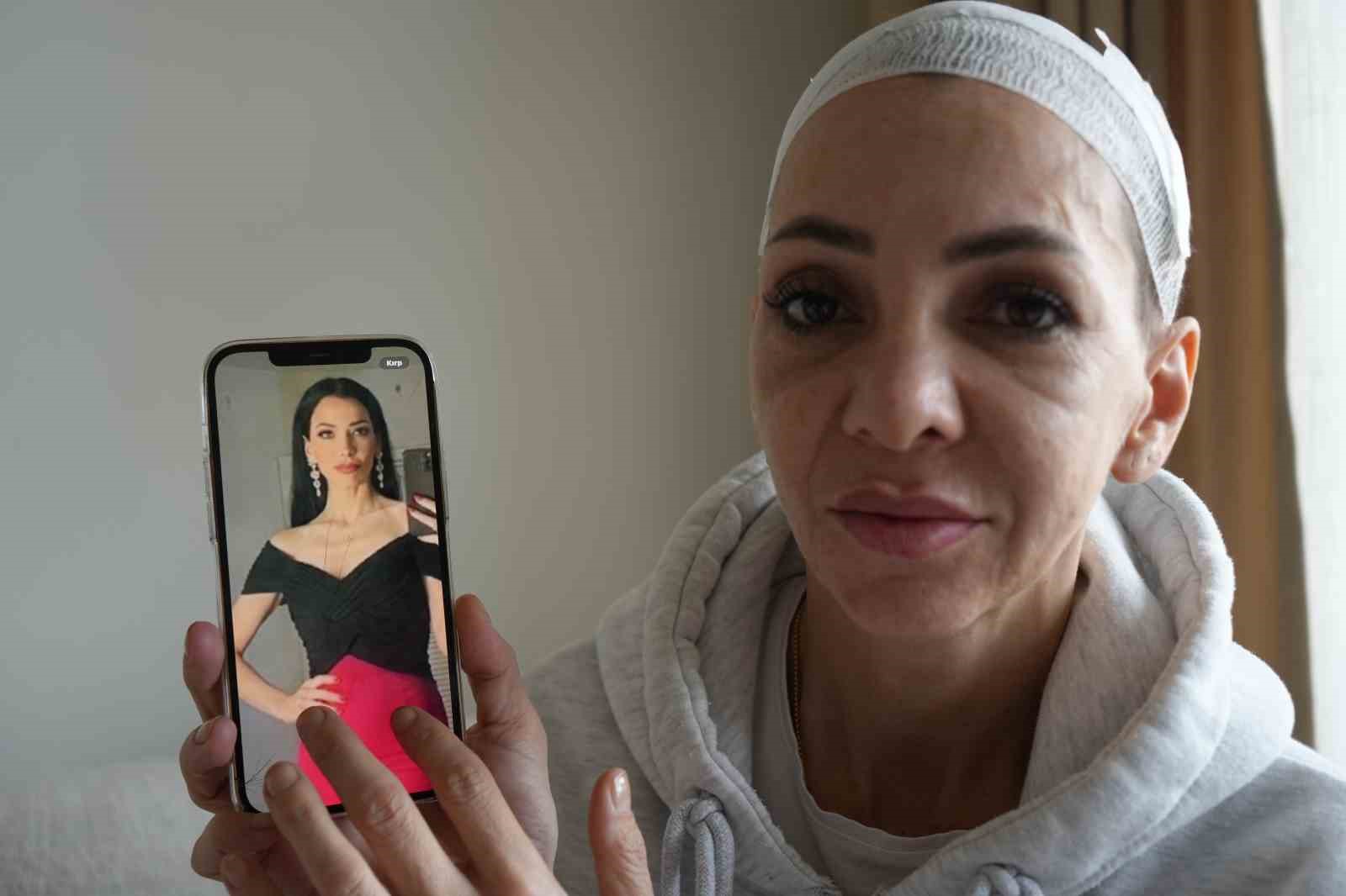 anne ve oglunu olduresiye darp eden supheliler merdivenlerden dustu 0 P5mZy6v9