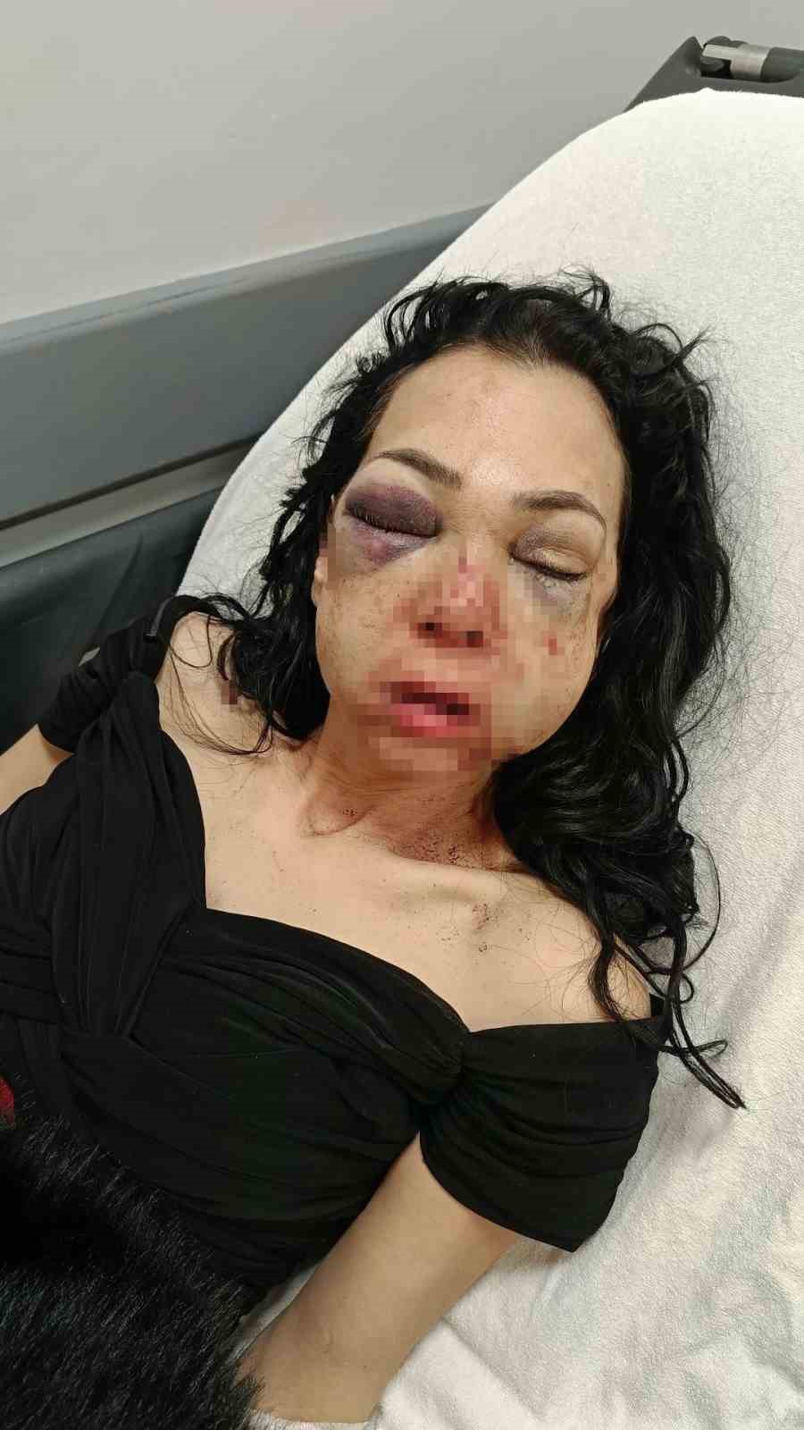anne ve oglunu olduresiye darp eden supheliler merdivenlerden dustu 4 Cbm1wVZ1