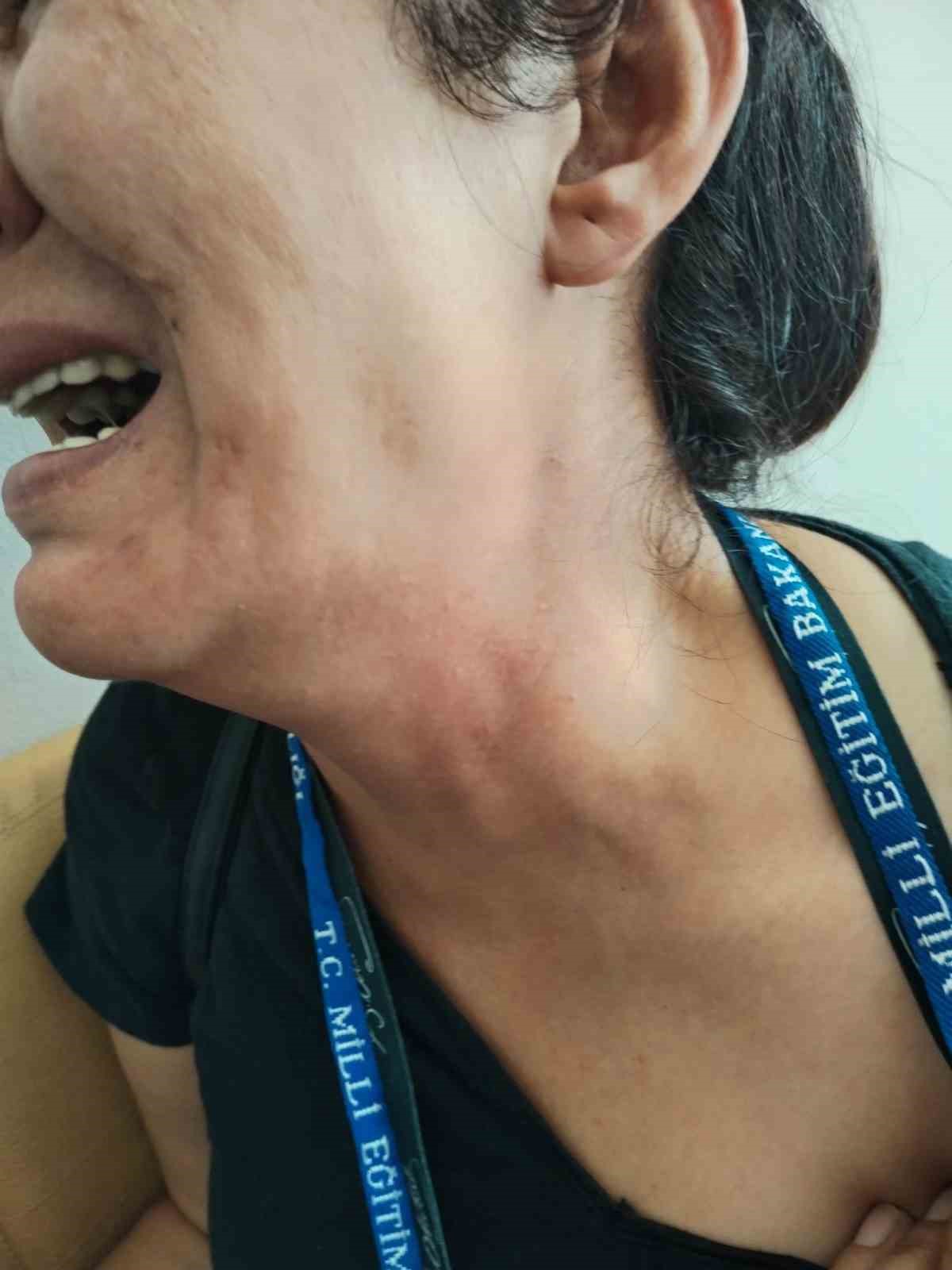 antalyada velinin ogretmeni darbettigi iddiasi 2