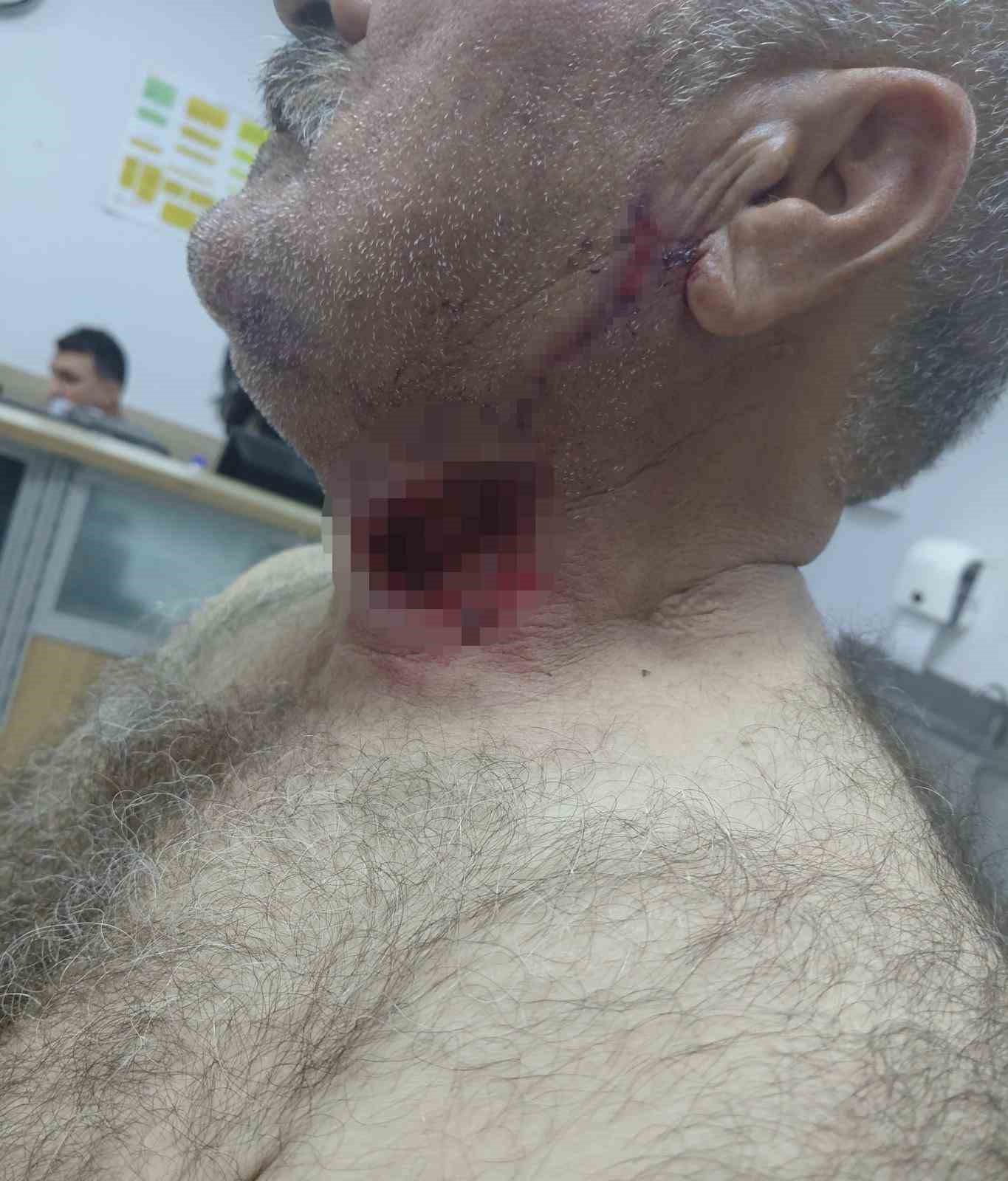 at sahibini bogazindan isirarak agir yaraladi 1 5KwByqla