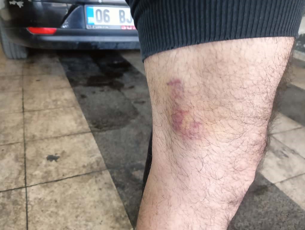 Ayırmaya çalıştığı kavga nedeniyle 3 yaşındaki oğlunun yanında saldırıya uğradı 5 ayirmaya calistigi kavga nedeniyle 3 yasindaki oglunun yaninda saldiriya ugradi 1 LGjzepD9