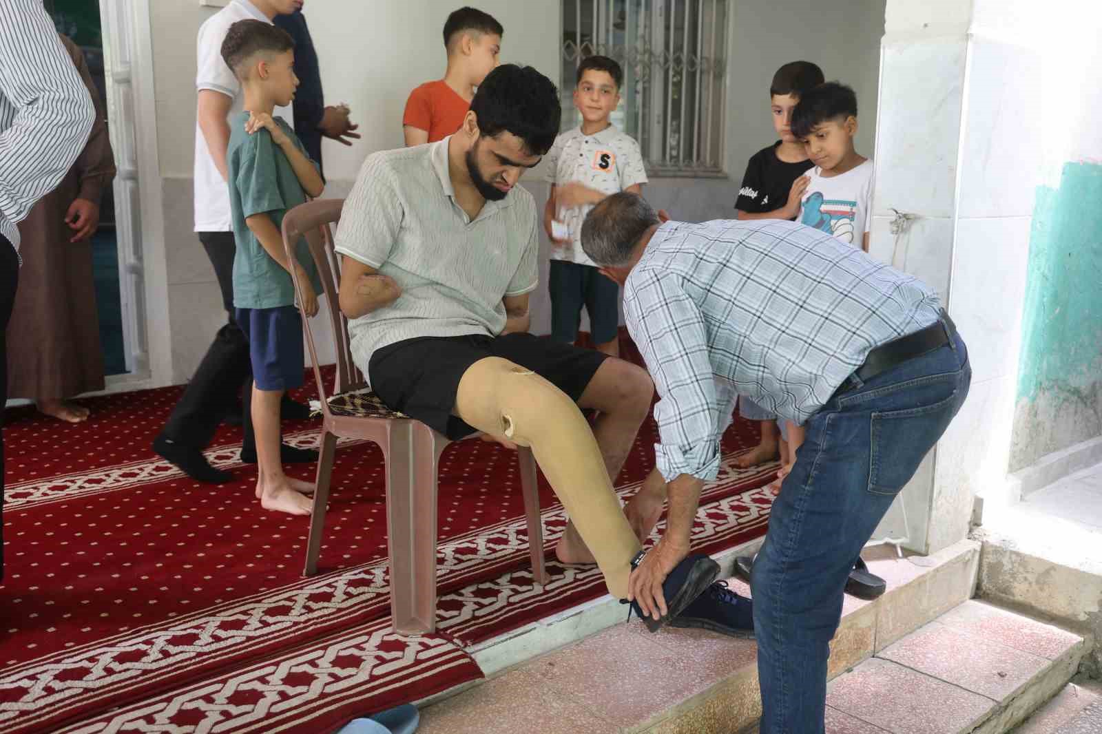 babasina uzattigi demirin elektrik tellerine degmesiyle akima kapilarak kollarini ve bacagini kaybeden ahmet ibadet D1Z39y8w