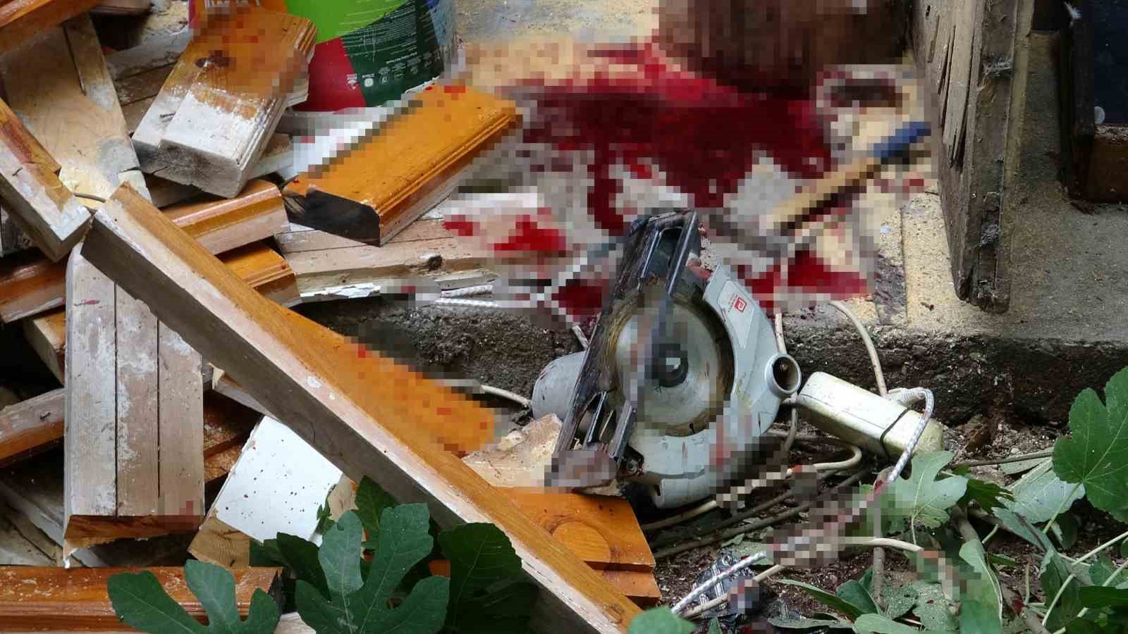 bacagini elektrikli testereye kaptiran yasli adam agir yaralandi olayi haber alan torun gozyaslarina boguldu zndnbCvj