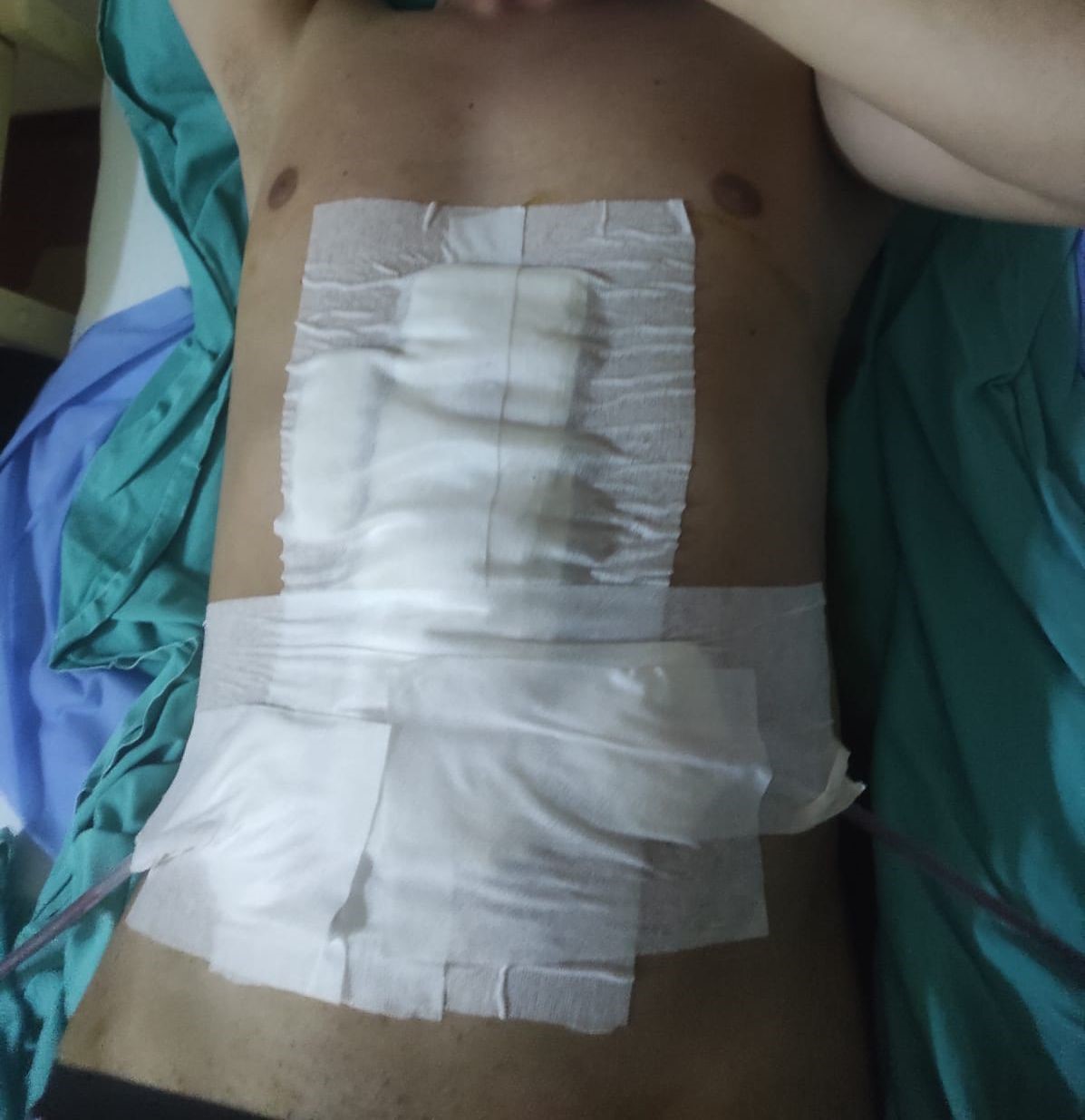 Bandırma’da havalı tüfek kazası: 1 ağır yaralı 5 bandirmada havali tufek kazasi 1 agir yarali 1