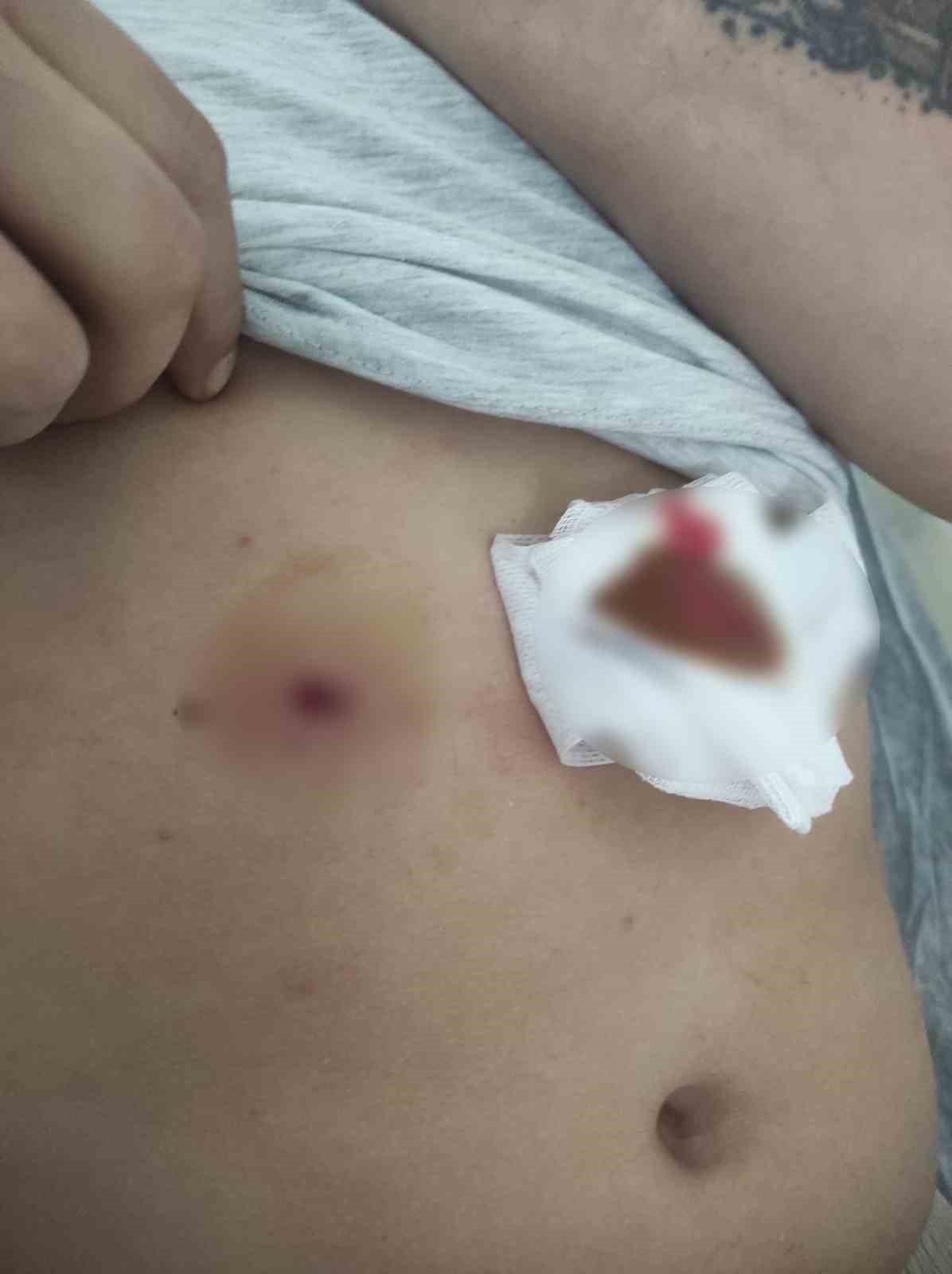 Bandırma’da havalı tüfek kazası: 1 ağır yaralı 6 bandirmada havali tufek kazasi 1 agir yarali 2