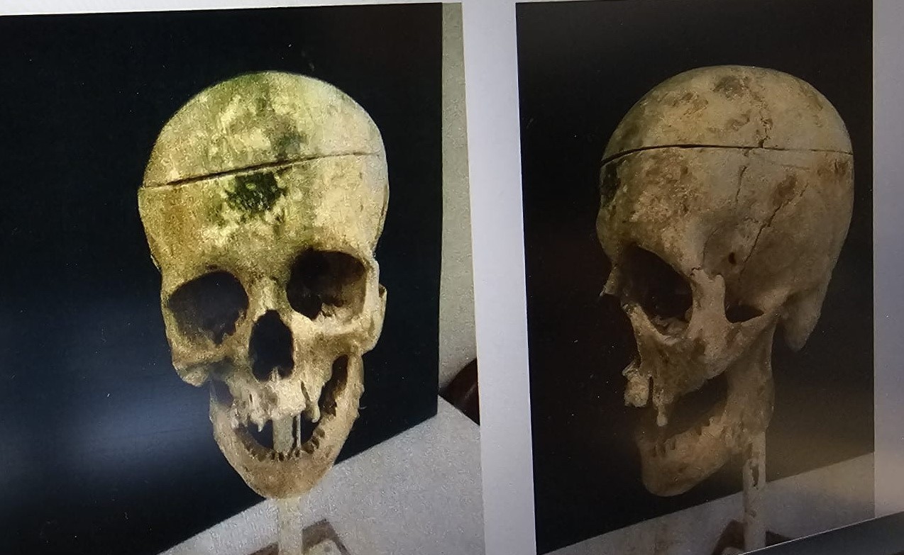 barajdaki kemiklerle 18 yillik cinayetin sirri cozuldu 0 LWbs5bUy