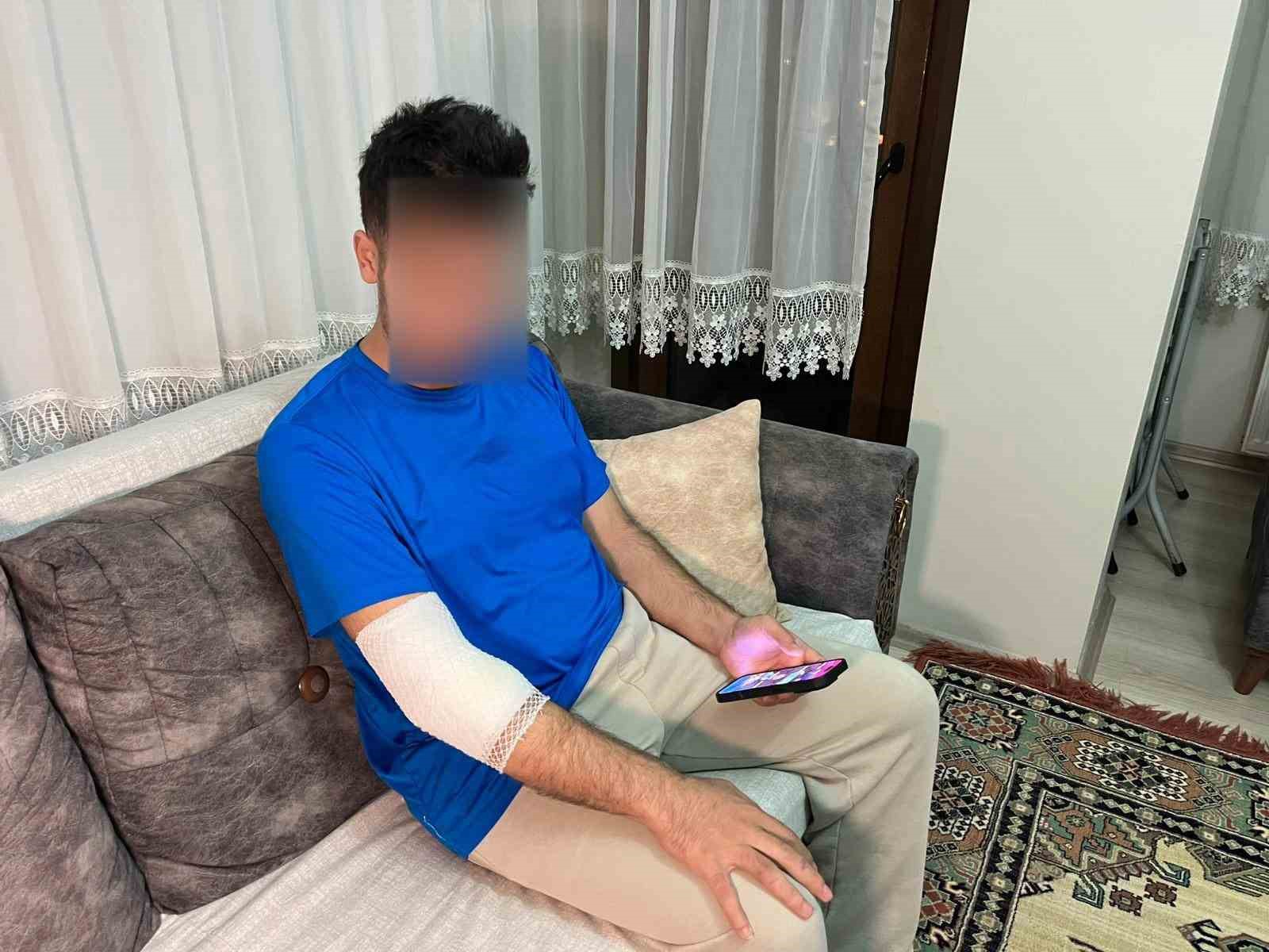 basaksehirde sitenin guvenlik gorevlisine sahipli kopek saldirdi 2