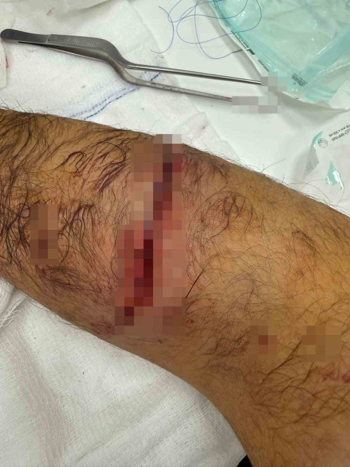 basaksehirde sitenin guvenlik gorevlisine sahipli kopek saldirdi 7 mkQdYtWU