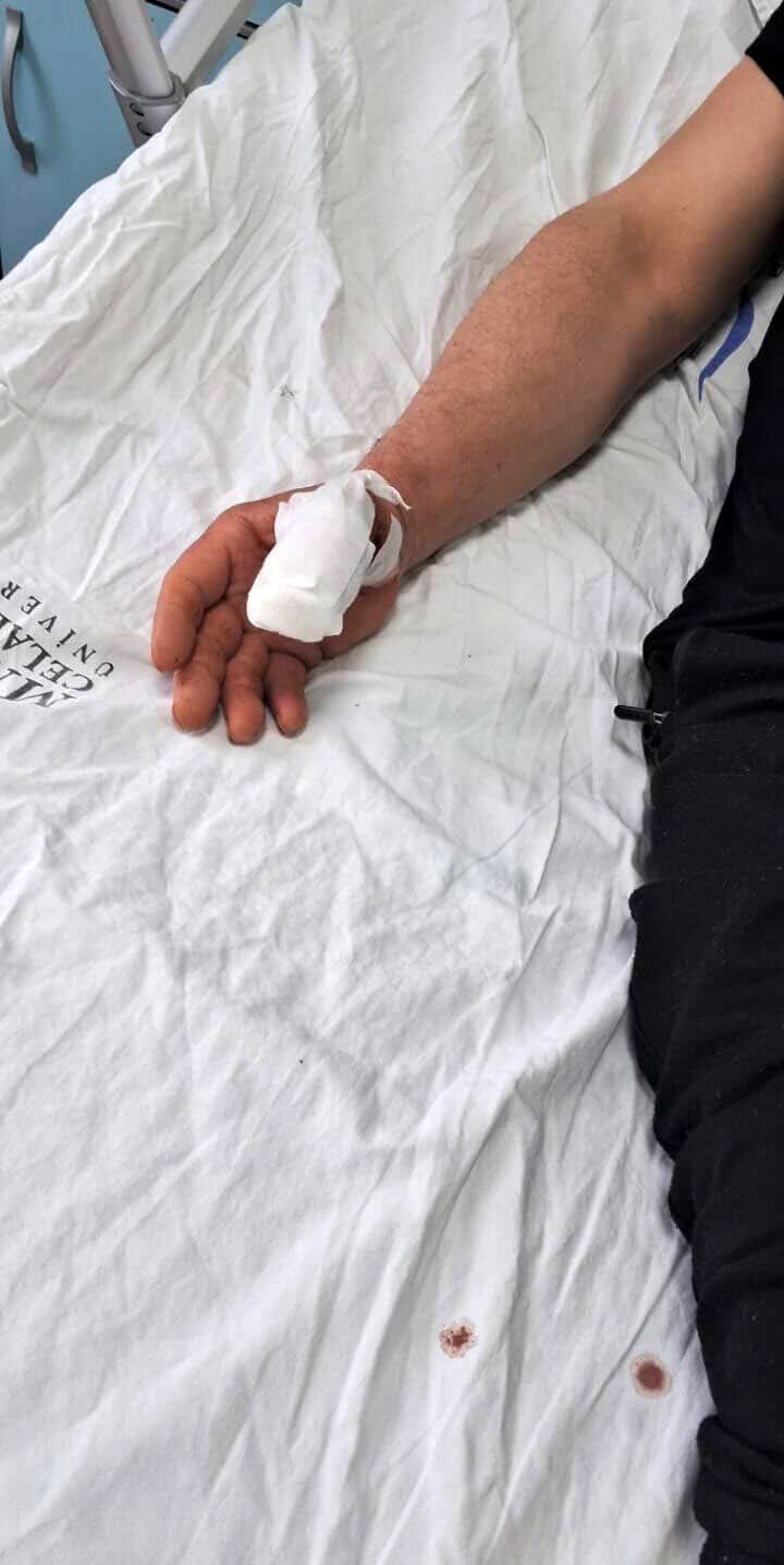 basibos kopeklerin saldirisina ugrayan adamin bas parmagi koptu 1 lDUEJnDW