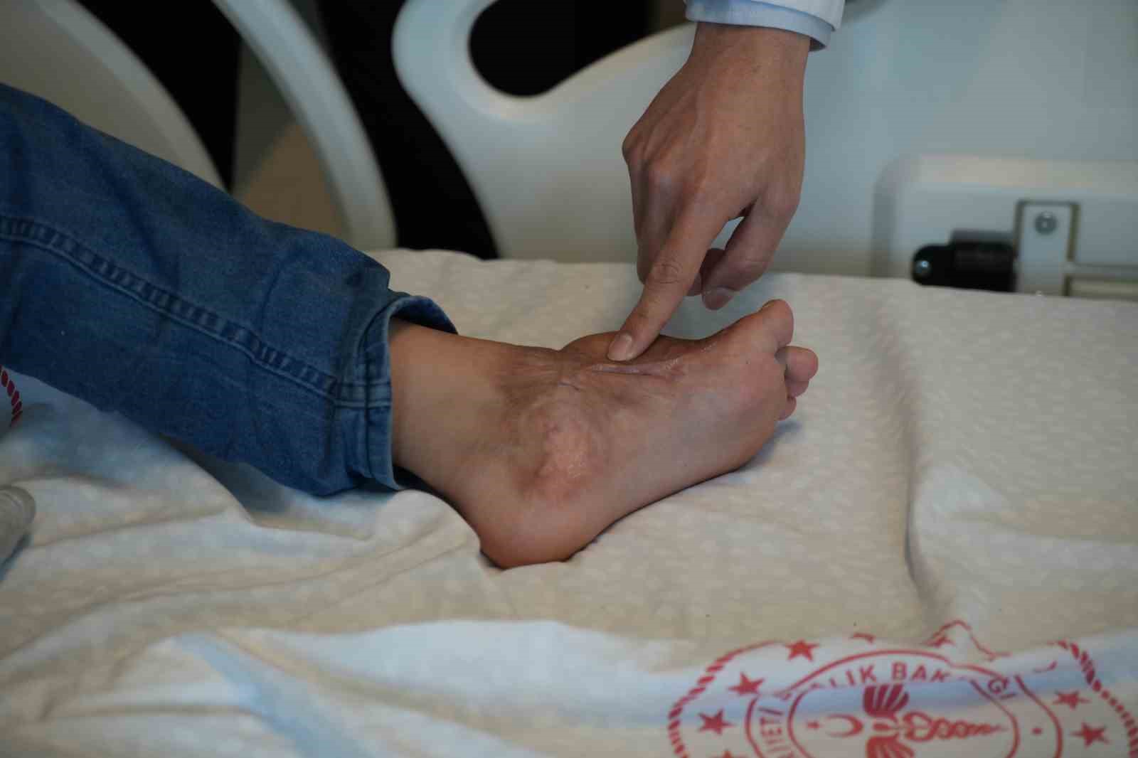Başparmağında ileri derece hareket kısıtlılığı olan çocuk, operasyonla sağlığına kavuştu 7 basparmaginda ileri derece hareket kisitliligi olan cocuk operasyonla sagligina kavustu 3 4tjgyyUa