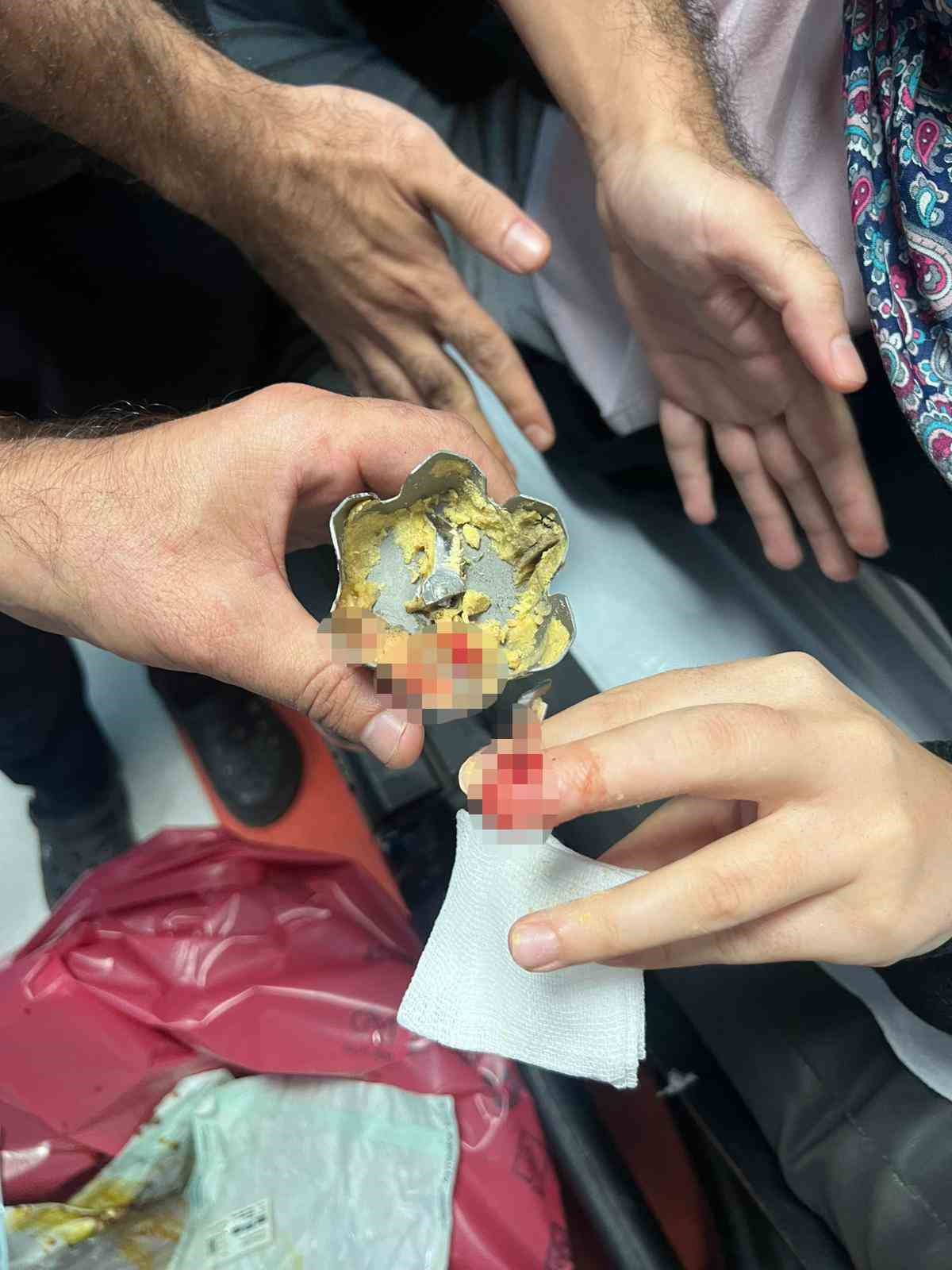 Batman’da yemek hazırlayan bayanın parmağına blender kesimi battı 5 batmanda yemek hazirlayan bayanin parmagina blender kesimi batti 1 EutdKiHJ