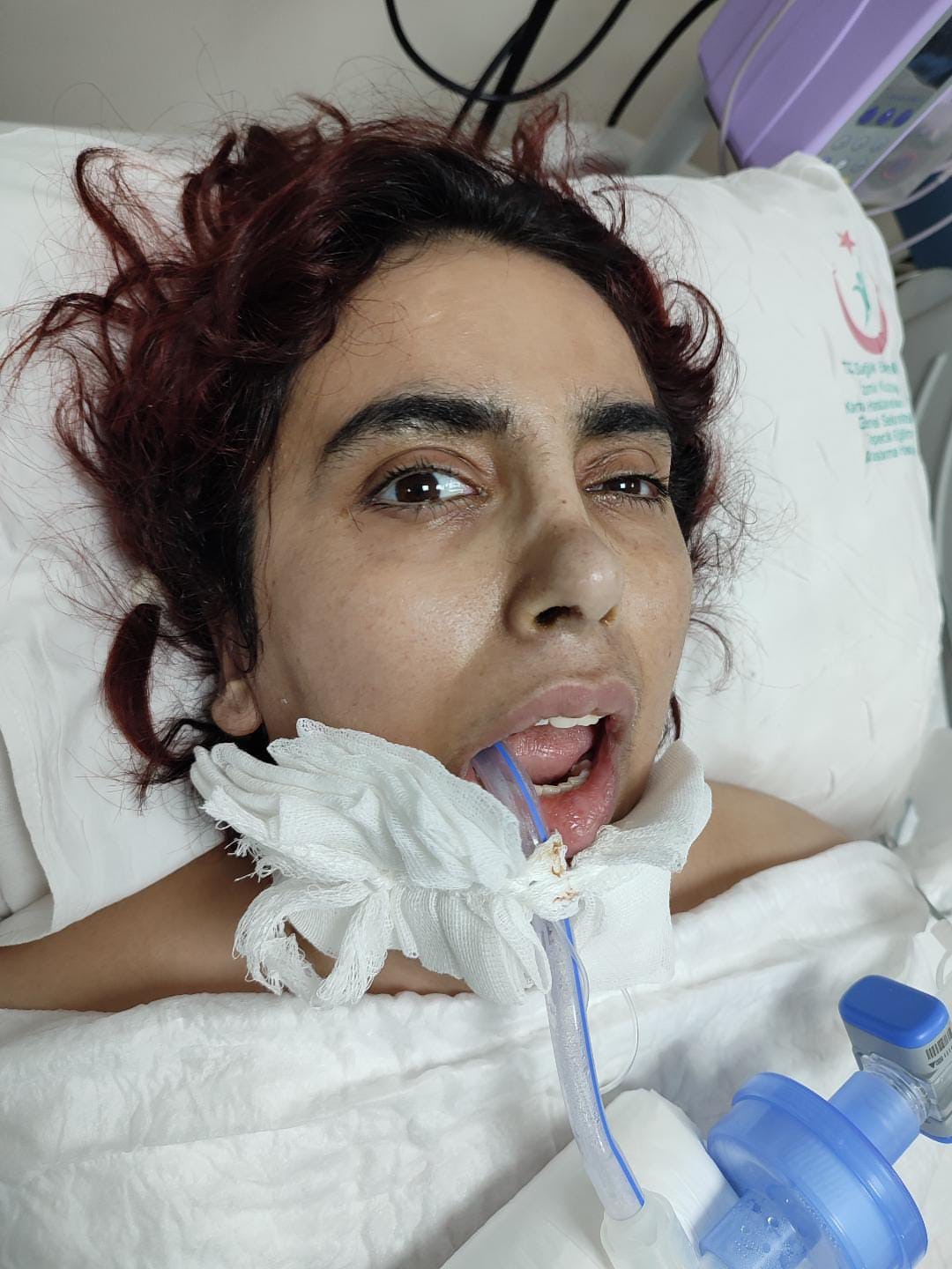 beyin felcine ragmen pes etmedi yeniden dogusun hik yesini yaziyor 7 frIkTlAC