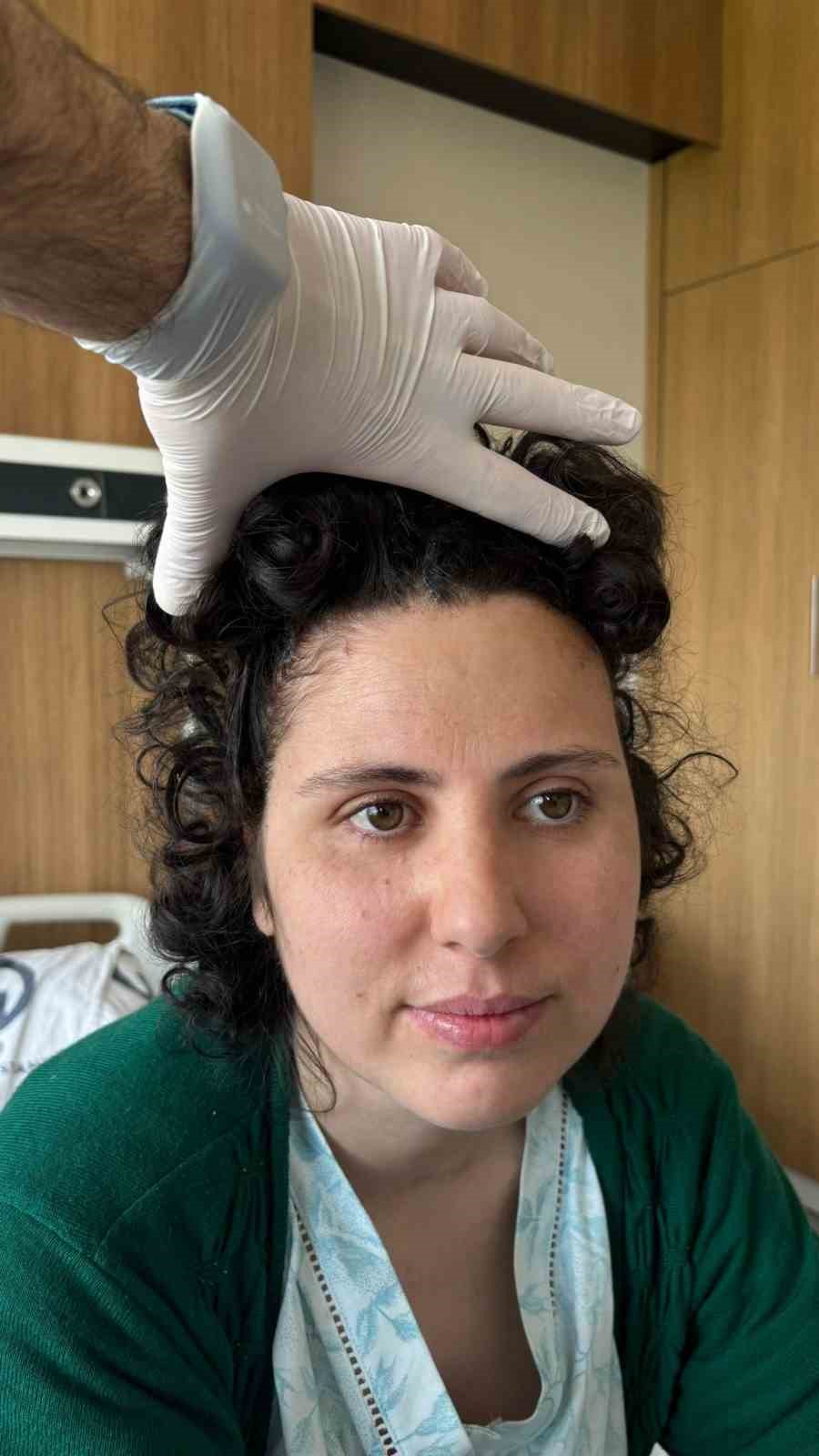 Beyin tümörü ameliyatı sonrası çöken alnı, 3 boyutlu implantla düzeltildi 10 beyin tumoru ameliyati sonrasi coken alni 3 boyutlu implantla duzeltildi 6 FiVuNNgW