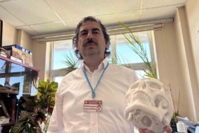 beyin-tumoru-ameliyati-sonrasi-coken-alni-3-boyutlu-implantla-duzeltildi-GpGjnsJF.jpg