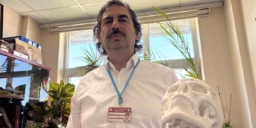 beyin-tumoru-ameliyati-sonrasi-coken-alni-3-boyutlu-implantla-duzeltildi-GpGjnsJF.jpg