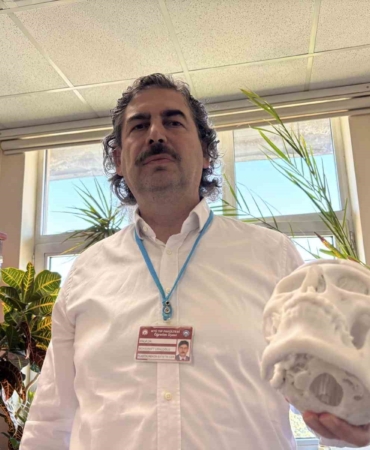 beyin-tumoru-ameliyati-sonrasi-coken-alni-3-boyutlu-implantla-duzeltildi-GpGjnsJF.jpg